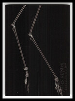2024 Topps Allen & Ginter X-rayd #XR-16 Greater Flamingo Legs