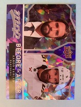 2021 Upper Deck MVP Before and After #BA-20 Aaron Ekblad